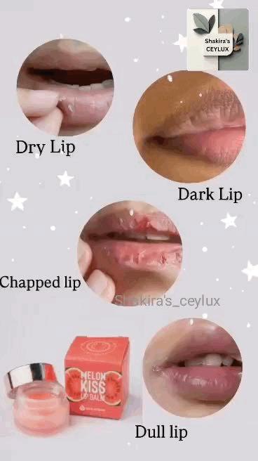 MELON KISS LIP BALM 