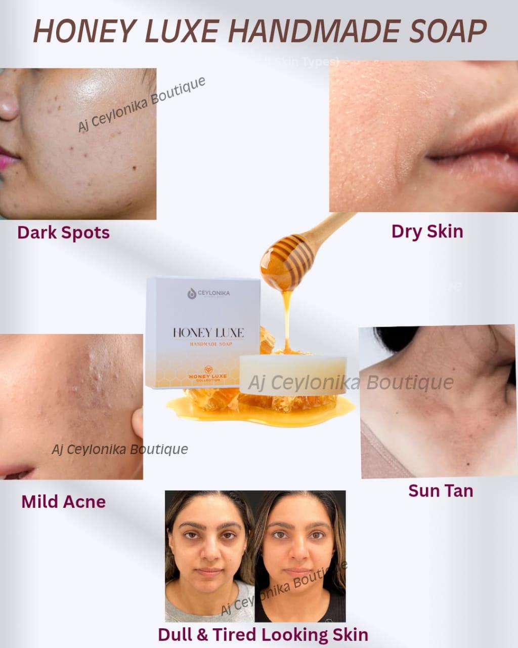 Honey Luxe Hand Made Soap🍯✨